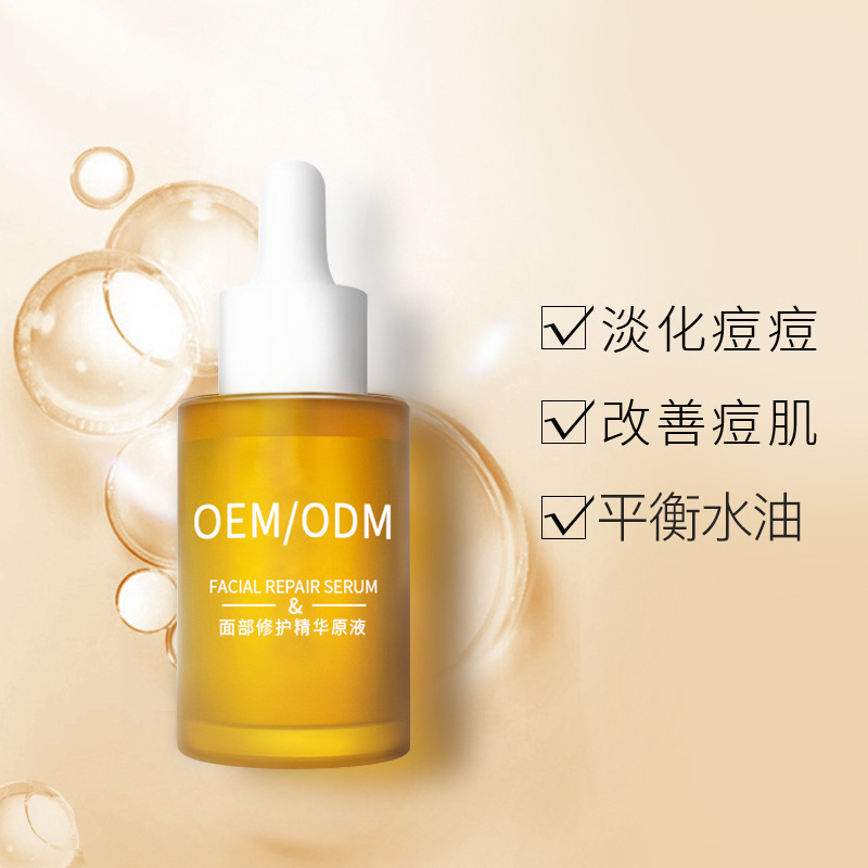 忻州市_祛痘精华原液OEM